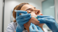 Fettwegspritze Zürich: Expert injection treatment in a state-of-the-art clinic setting for targeted fat reduction